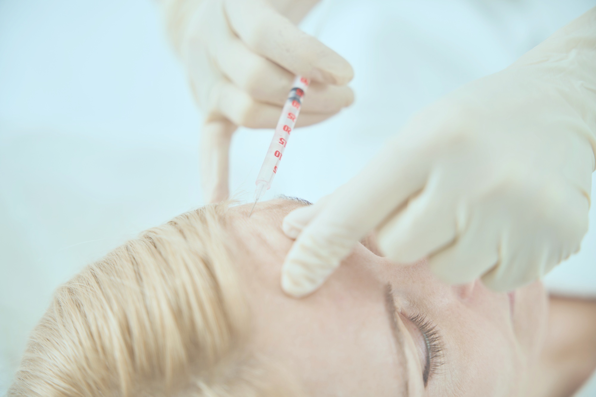 Botox and Its Role in Transforming Aesthetic Standards: A Cultural Perspective